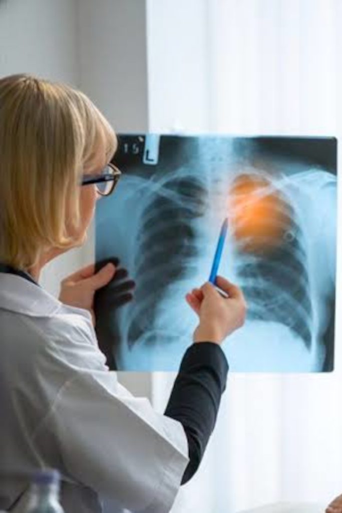 pneumologia